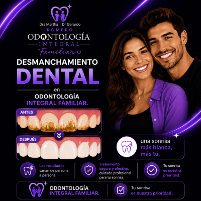Desmanchamiento dental-02