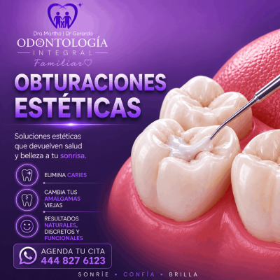 Obturaciones estéticas-02