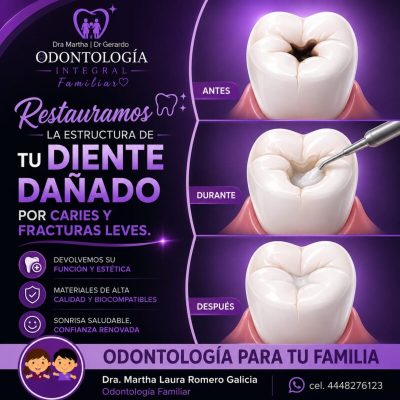 obturaciones